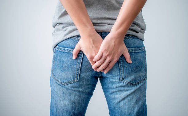 Abses Perianal Kenali Penyebab, Gejala Dan Penanganannya
