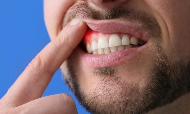 Pembengkakan Gusi Membuat Kondisi Mulut Tidak Nyaman