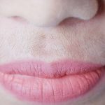 Hirsutisme Pada Wanita, Ini Dia Penyebab Utamanya!