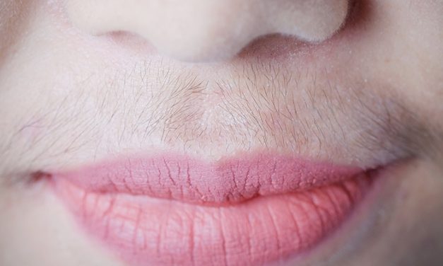 Hirsutisme Pada Wanita, Ini Dia Penyebab Utamanya!